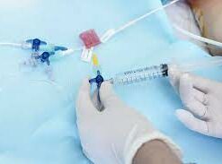 peripheral nerve catheter